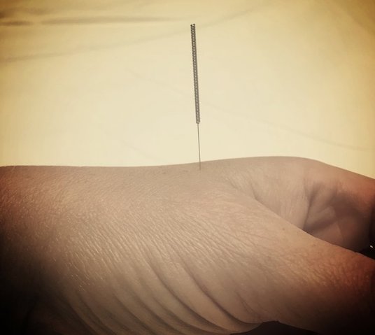 Needle+in+Hand